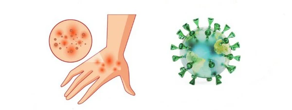 product-1-1 product-1-1