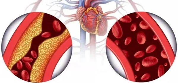 product-1-1 product-1-1